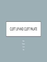 Cleft Lip and Cleft Palate PowerPoint Presentation