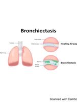 CLASS NOTES PRESENTATION- BRONCHIECTASIS WITH SUPPORTIVE DIAGRAMS