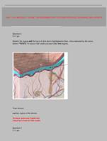 A&P 1 101 MODULE 7 EXAM 7 INTERGUMENTARY SYSTEM PORTAGE LEARNING 2024 UPDATE