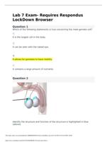 Lab 7 Exam- Requires Respondus LockDown Browser questions and answers 2024